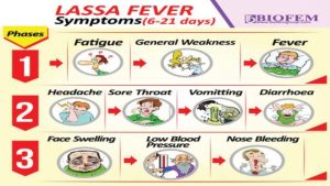 lassa fever